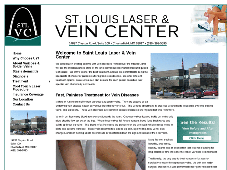 www.saintlouisvaricoseveincenter.com