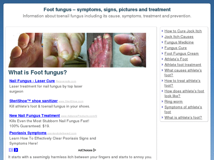 www.footfungus.info