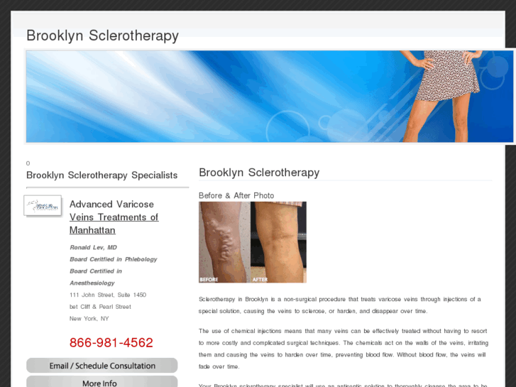 www.brooklynsclerotherapy.com