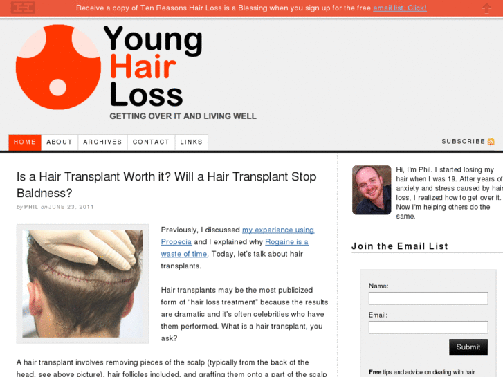 www.younghairloss.com