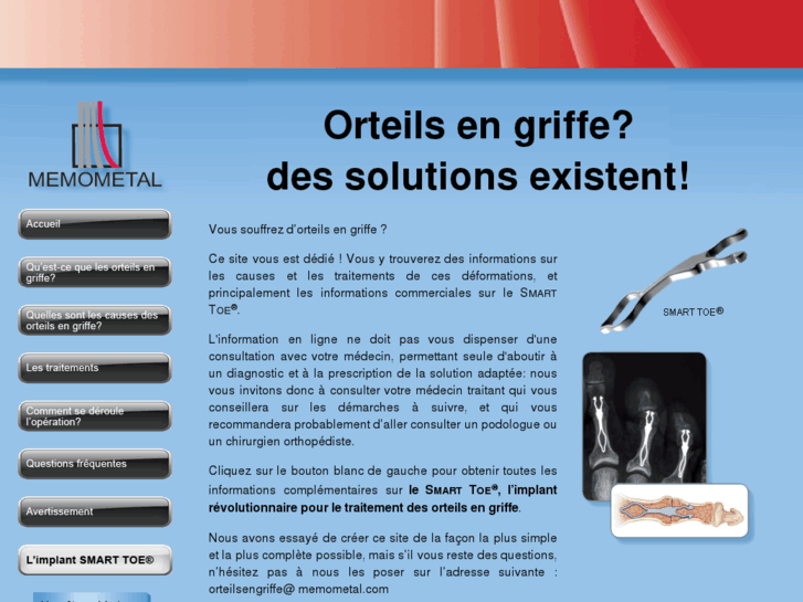 www.orteilsengriffe.com