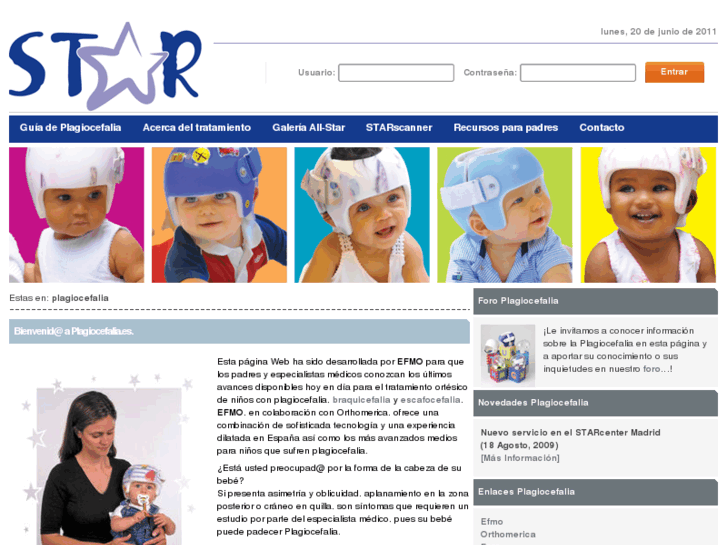 www.plagiocefalia.es