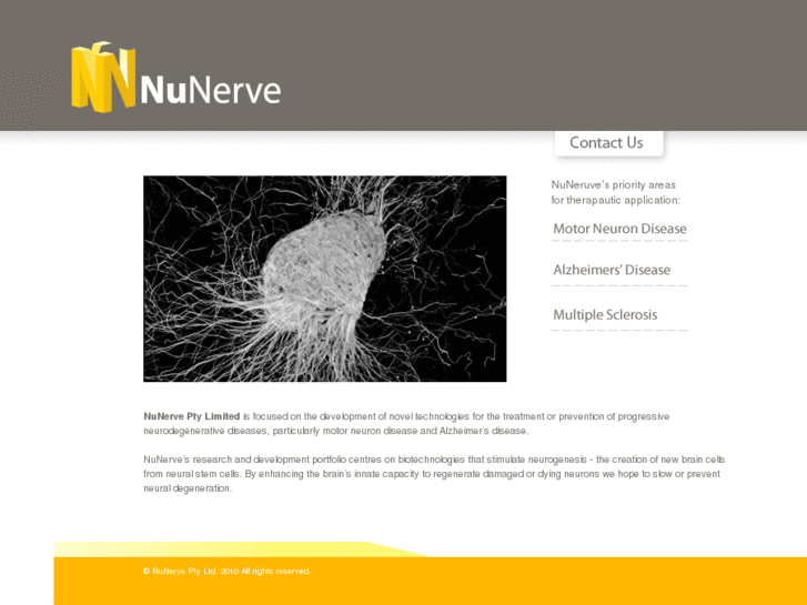 www.nunerve.com
