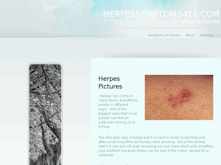 www.herpessymptoms411.com