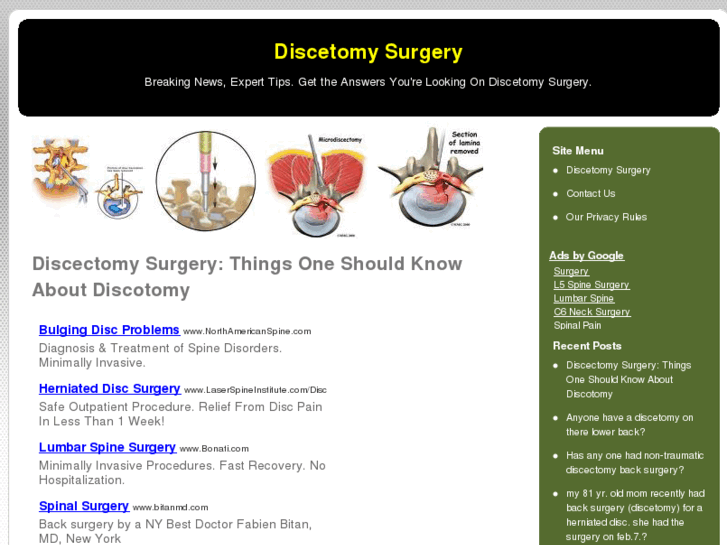 www.discectomysurgery.net