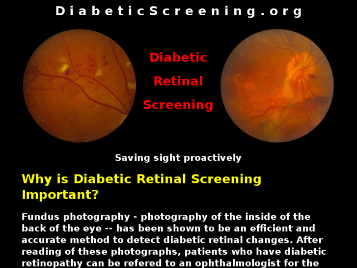 www.diabeticscreening.com