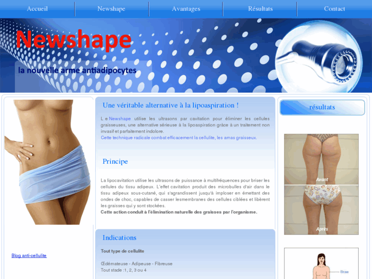 www.top-lipo.ch