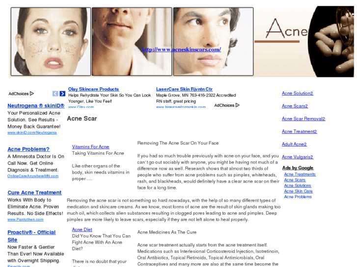 www.acneskinscars.com