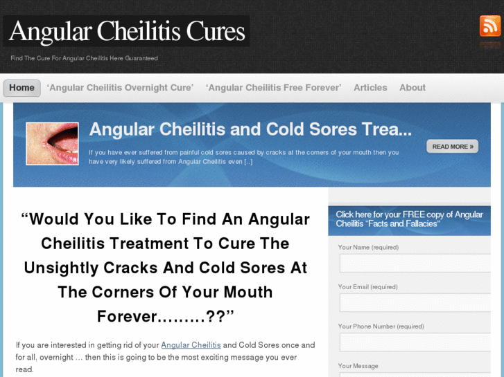 www.angularchelitis.net