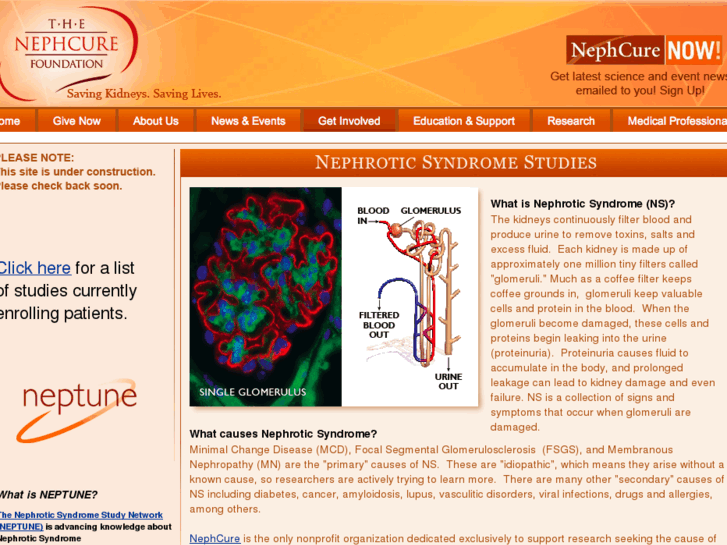 www.nephrotic-syndrome-studies.com