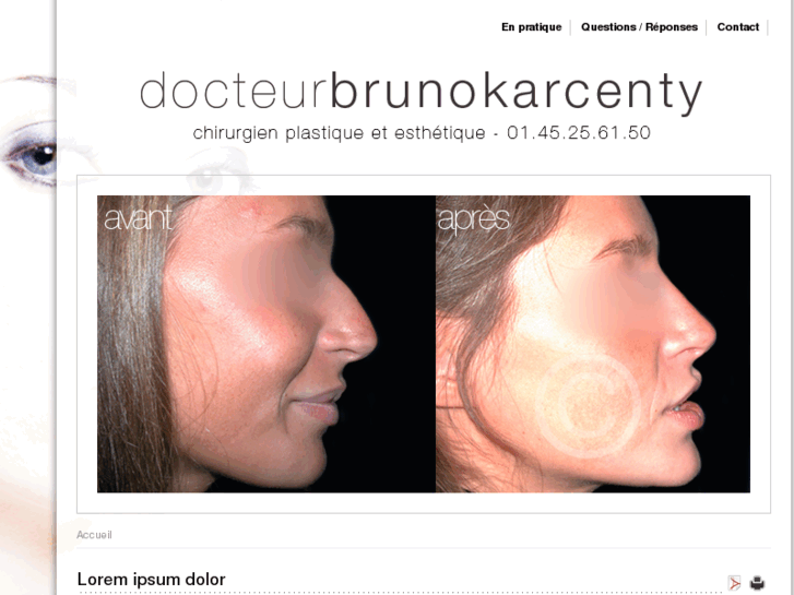 www.rhinoplastie-esthetique.com