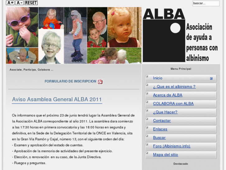 www.albinismo.es