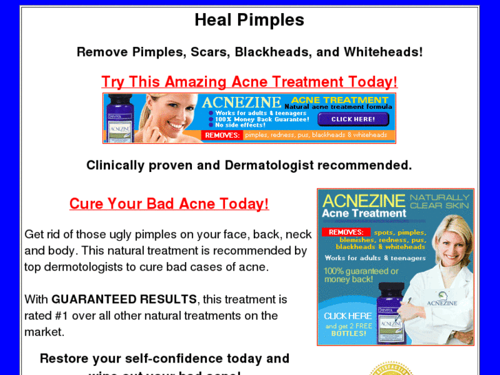 www.healpimples.com