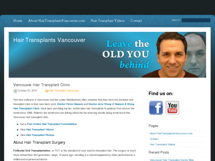 www.hairtransplantsvancouver.com