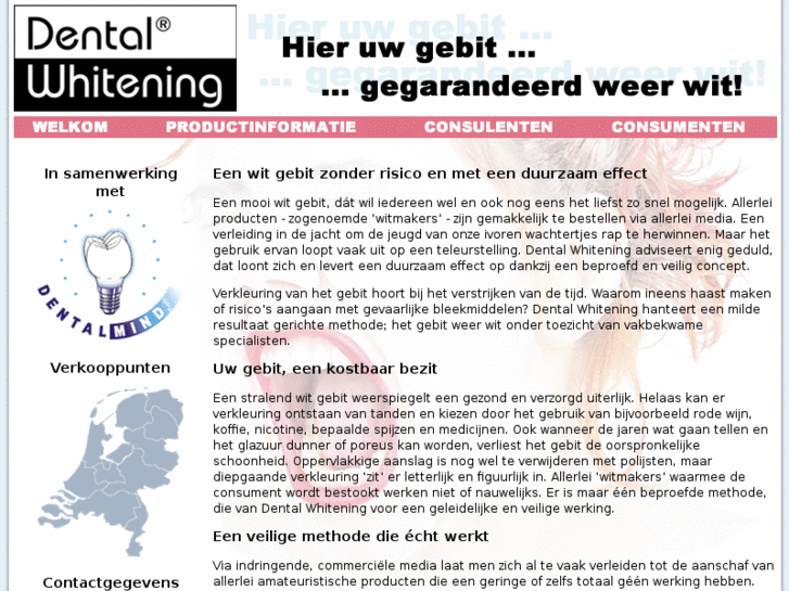 www.dentalwhitening.nl