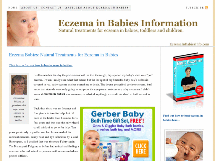 www.eczemababies.com