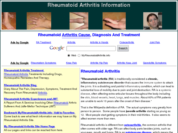 www.myrheumatoidarthritis.info
