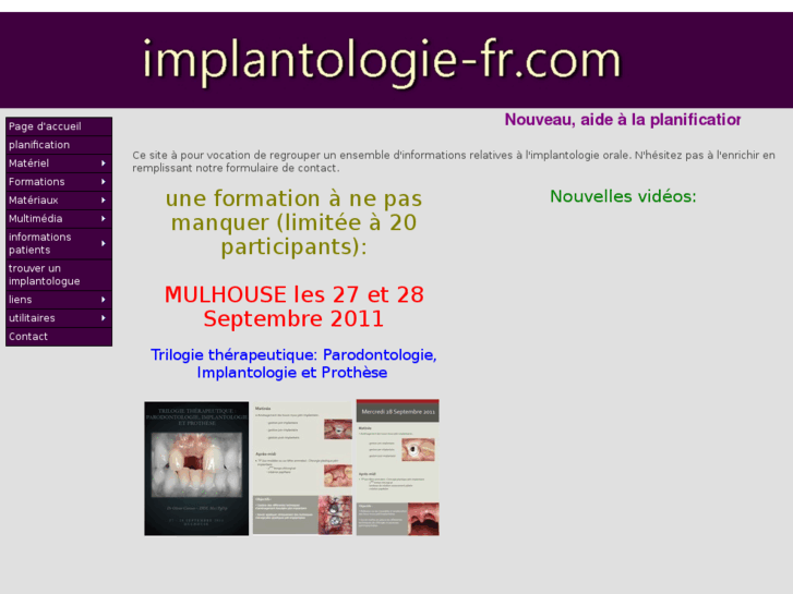 www.implantologie-fr.com