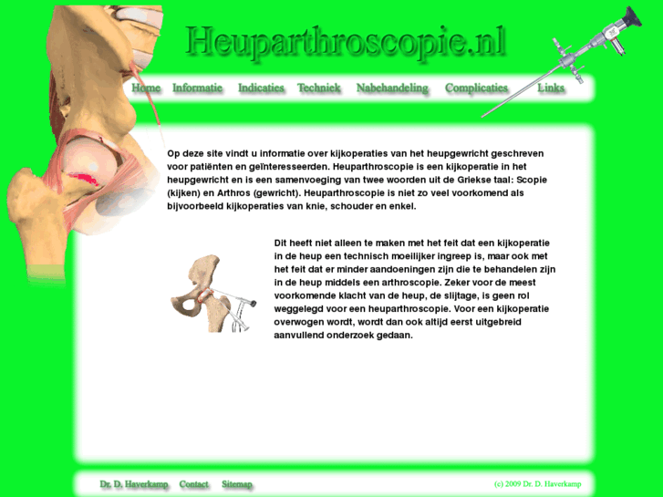 www.heuparthroscopie.nl