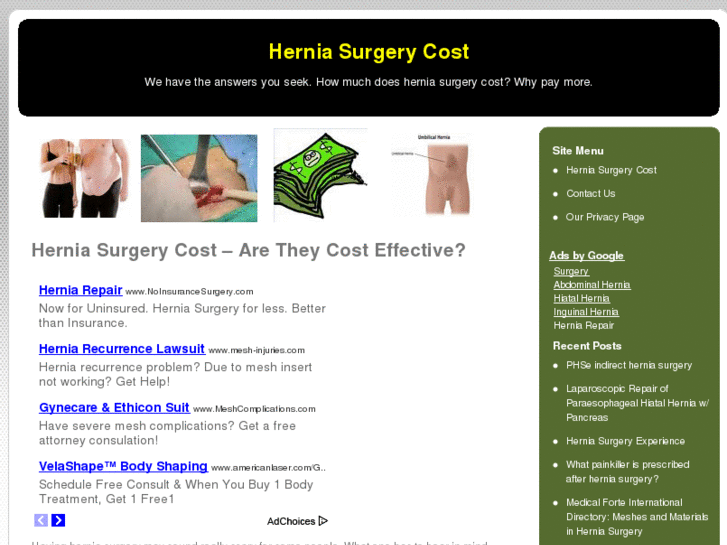 www.herniasurgerycost.net