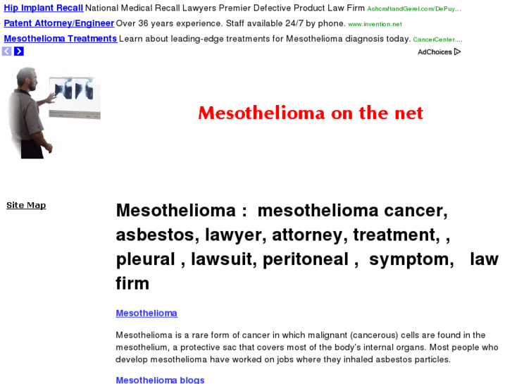 www.mesotheliomaonthe.net