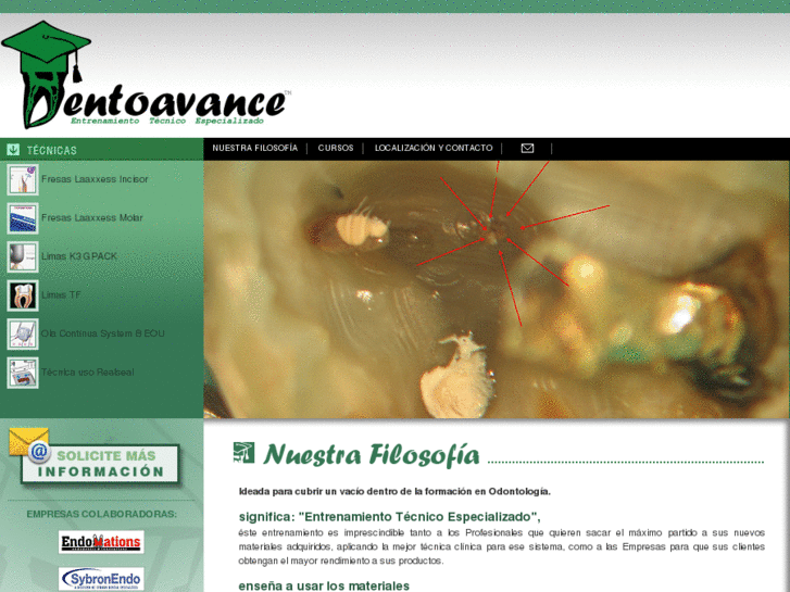 www.dentoavance.com