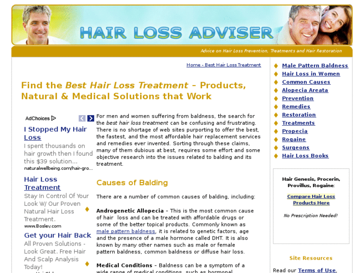 www.hair-loss-adviser.com