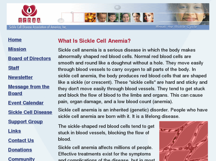 www.sicklecellaz.org