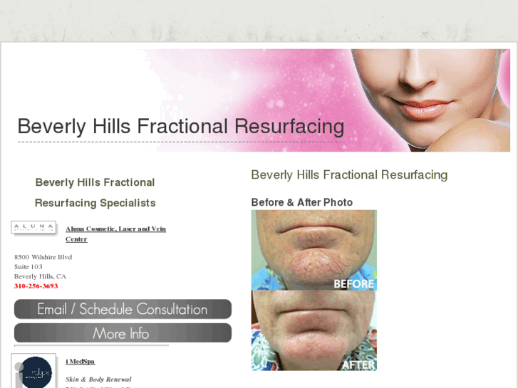 www.beverlyhillsfractionalresurfacing.com