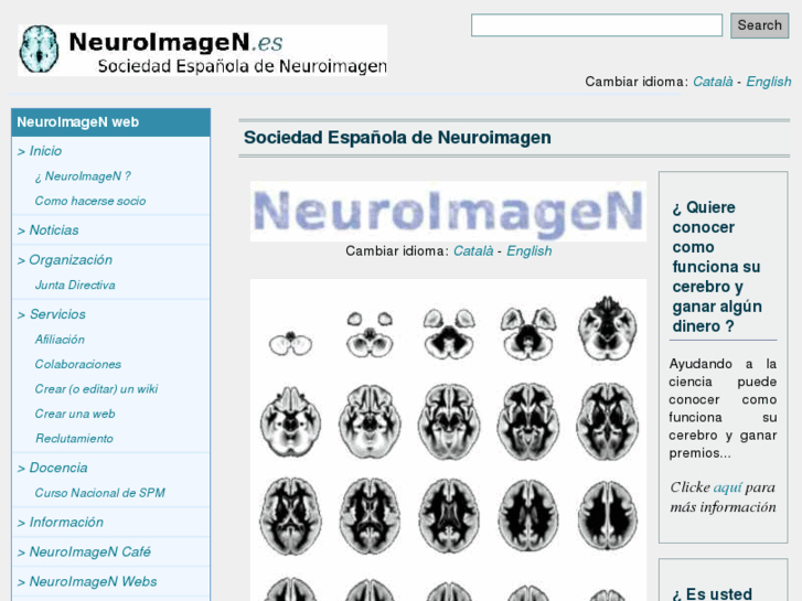 www.neuroimagen.es