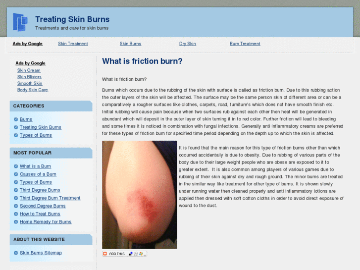 www.treatingskinburns.net