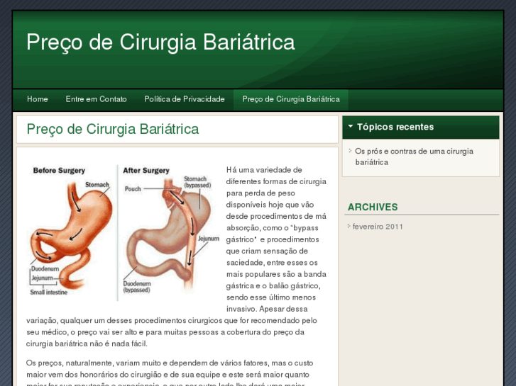 www.cirurgiabariatricapreco.info