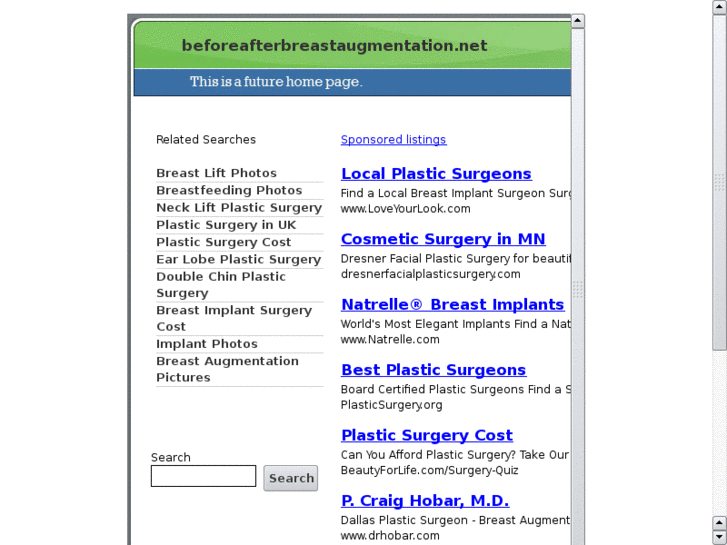 www.beforeafterbreastaugmentation.net