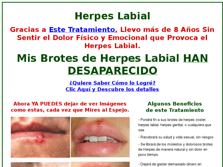 www.herpes-labial.net