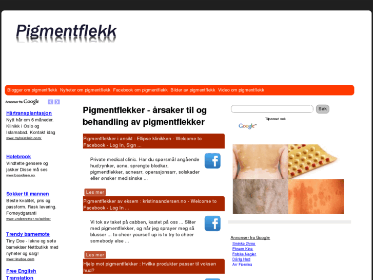 www.pigmentflekker.com