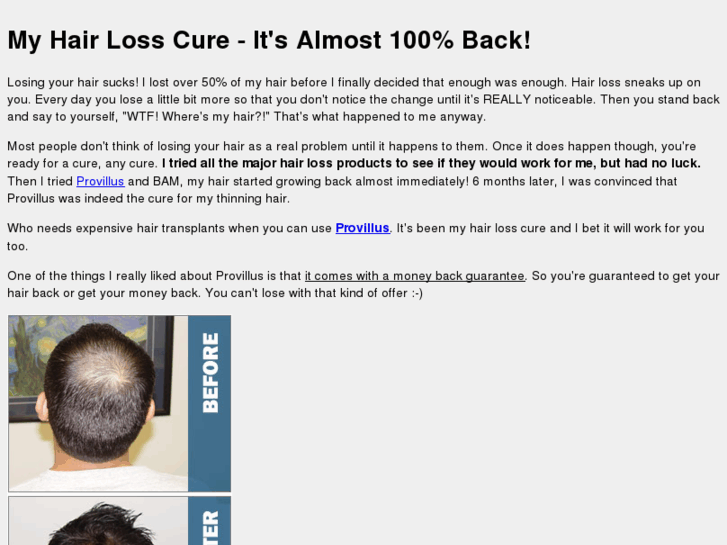 www.hairlosscure.org