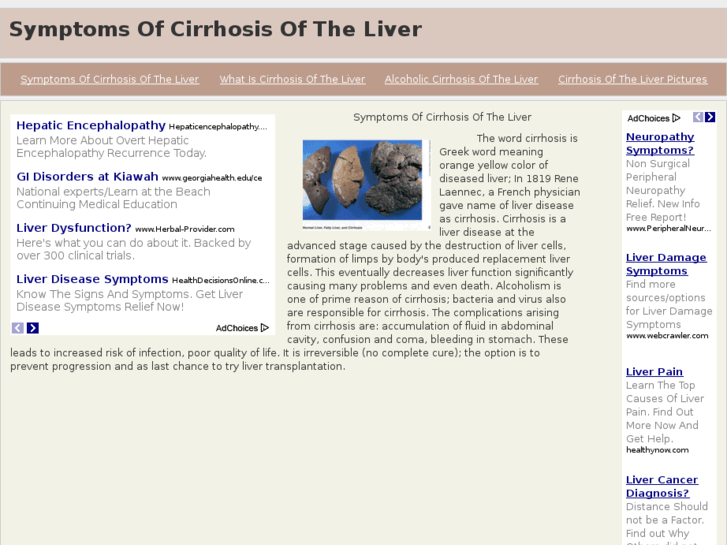 www.symptomsofcirrhosisoftheliver.com