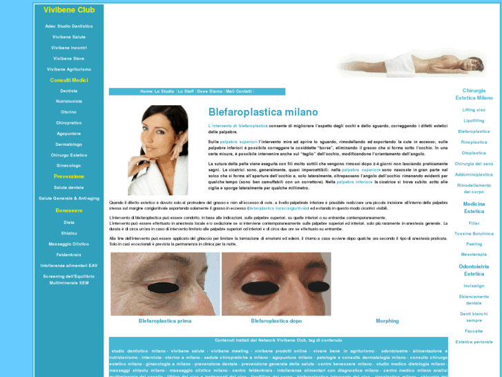 www.blefaroplasticamilano.it