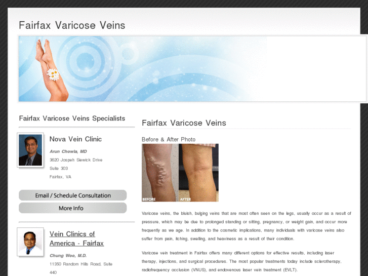 www.fairfaxvaricoseveins.net