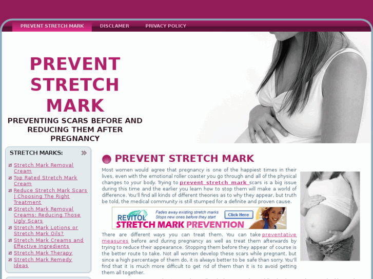 www.preventstretchmark.net