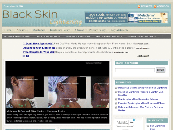 www.blackskinlightening.com