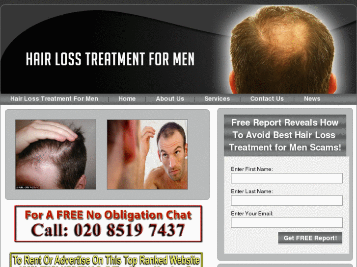 www.besthairlosstreatmentformen.co.uk