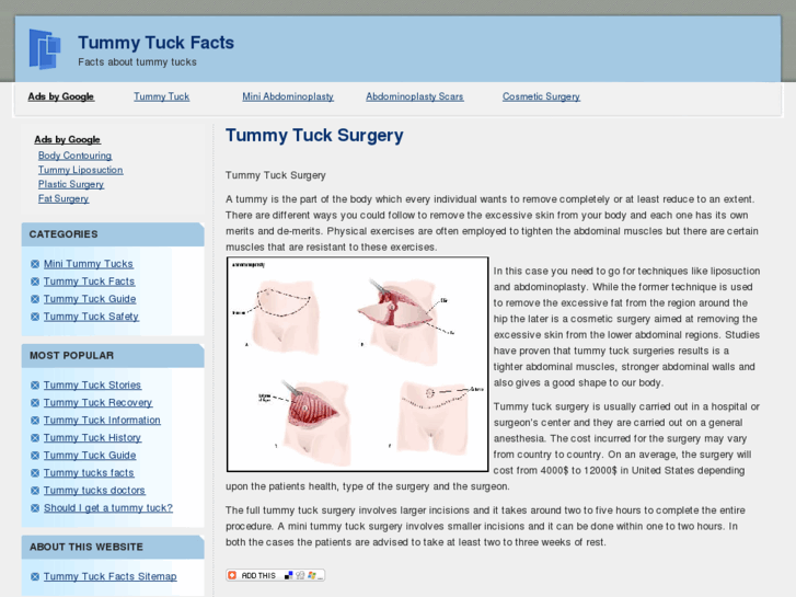 www.tummytuckfacts.com