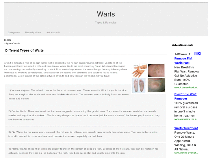 www.differenttypesofwarts.net