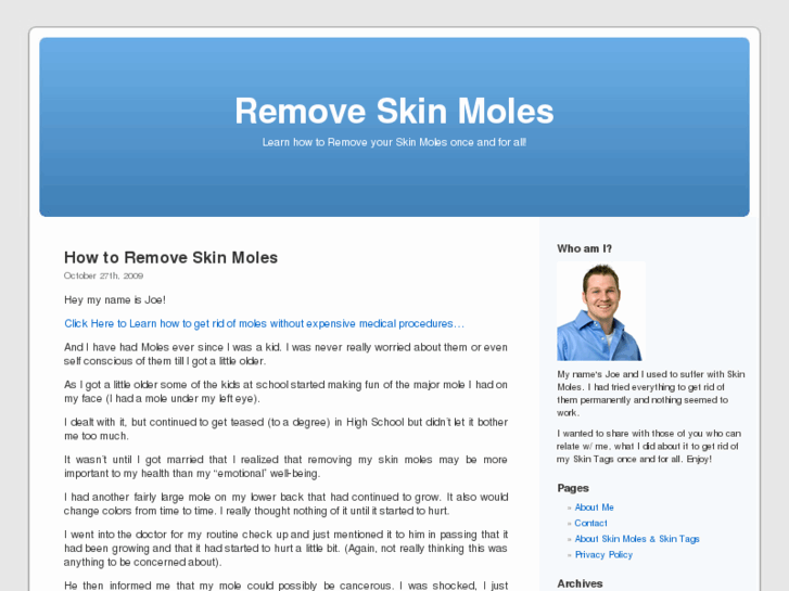 www.removeskinmoles.org