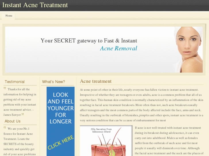 www.instantacnetreatment.com