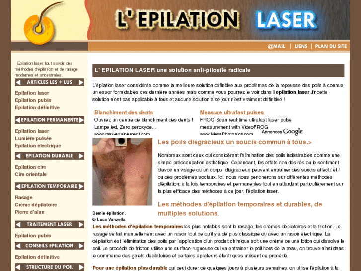 www.lepilation-laser.fr