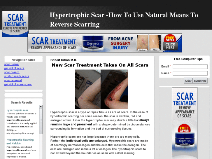 www.hypertrophicscar.org