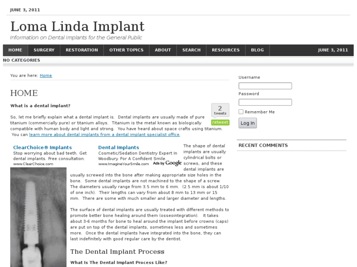 www.lomalindaimplant.com