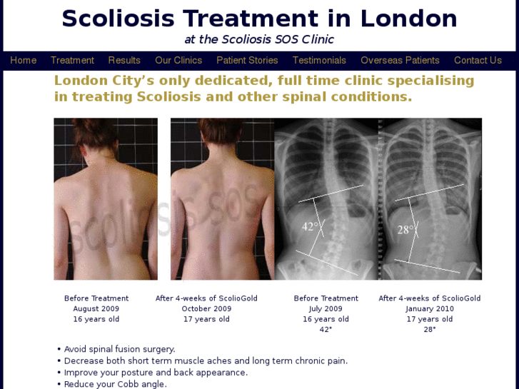 www.scoliosis-treatment-in-london.co.uk